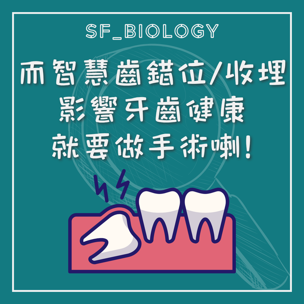 智慧齒影響鄰近牙齒時的牙科評估與處理