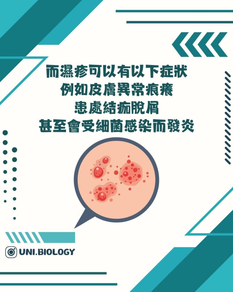 【DSE Bio 生物日常】到底咩係濕疹？異位性皮膚炎成因、症狀與日常護理全面拆解｜DSE Biology 圖卡 9