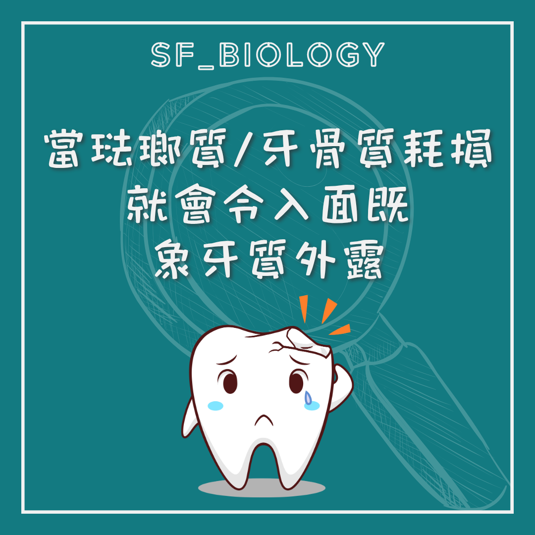 琺瑯質或牙骨質耗損令牙本質暴露示意