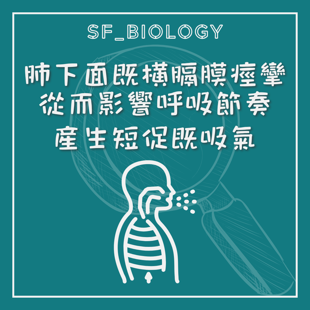 橫隔膜痙攣令吸氣突然出現的示意